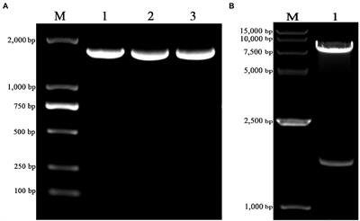 Development of an Indirect ELISA Kit for Rapid Detection of Varicella-Zoster Virus Antibody by Glycoprotein E